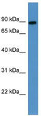 Lysyl Oxidase Like 3 antibody, TA342895, Origene, Western Blot image 