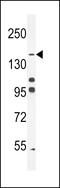 Protein Tyrosine Phosphatase Receptor Type J antibody, LS-C166881, Lifespan Biosciences, Western Blot image 