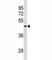 RNA Binding Motif Protein, Y-Linked, Family 1, Member A1 antibody, F40054-0.4ML, NSJ Bioreagents, Western Blot image 