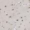 THO Complex 1 antibody, NBP1-89670, Novus Biologicals, Immunohistochemistry frozen image 