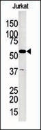 Glycerol Kinase antibody, 62-677, ProSci, Western Blot image 