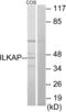 ILK Associated Serine/Threonine Phosphatase antibody, LS-C119253, Lifespan Biosciences, Western Blot image 