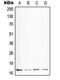 Somatostatin antibody, MBS822270, MyBioSource, Western Blot image 