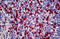 S100 Calcium Binding Protein A9 antibody, MBS244836, MyBioSource, Immunohistochemistry frozen image 