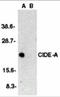 Cell Death Inducing DFFA Like Effector A antibody, 2085, ProSci, Western Blot image 