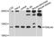 Thioredoxin-like U5 snRNP protein U5-15kD antibody, A10138, ABclonal Technology, Western Blot image 