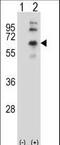 Cholinergic Receptor Muscarinic 2 antibody, LS-C168750, Lifespan Biosciences, Western Blot image 