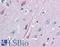 Neurotrophic Receptor Tyrosine Kinase 2 antibody, LS-B2544, Lifespan Biosciences, Immunohistochemistry paraffin image 