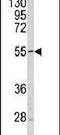 Sestrin 1 antibody, PA5-14679, Invitrogen Antibodies, Western Blot image 