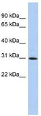 Zinc Finger Protein 771 antibody, TA339494, Origene, Western Blot image 