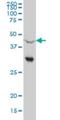 Nuclear Receptor Subfamily 0 Group B Member 1 antibody, H00000190-M03, Novus Biologicals, Western Blot image 