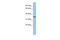 PHD Finger Protein 13 antibody, 26-589, ProSci, Western Blot image 