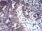 Histone Deacetylase 8 antibody, orb76105, Biorbyt, Immunohistochemistry paraffin image 