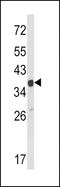 Actin Related Protein 2/3 Complex Subunit 1A antibody, LS-C156506, Lifespan Biosciences, Western Blot image 