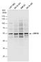 Zinc Finger Protein 24 antibody, GTX103755, GeneTex, Western Blot image 