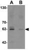 Potassium Two Pore Domain Channel Subfamily K Member 13 antibody, GTX31448, GeneTex, Western Blot image 
