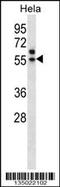 Transcriptional Adaptor 3 antibody, 57-974, ProSci, Western Blot image 