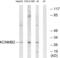 Potassium Calcium-Activated Channel Subfamily M Regulatory Beta Subunit 2 antibody, abx014285, Abbexa, Western Blot image 