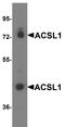 Acyl-CoA Synthetase Long Chain Family Member 1 antibody, PA5-72767, Invitrogen Antibodies, Western Blot image 