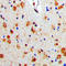 Arrestin Beta 1 antibody, LS-C353902, Lifespan Biosciences, Immunohistochemistry paraffin image 