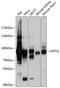 Mitochondrial TRNA Translation Optimization 1 antibody, 23-798, ProSci, Western Blot image 