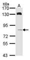 HPS6 Biogenesis Of Lysosomal Organelles Complex 2 Subunit 3 antibody, PA5-21859, Invitrogen Antibodies, Western Blot image 