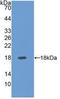 Selectin E antibody, LS-C314349, Lifespan Biosciences, Western Blot image 