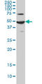 ADCYAP Receptor Type I antibody, LS-C196617, Lifespan Biosciences, Western Blot image 