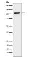 Lysine Demethylase 1A antibody, M00532-2, Boster Biological Technology, Western Blot image 