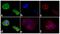 Insulin Receptor antibody, 44-804G, Invitrogen Antibodies, Immunofluorescence image 