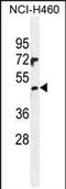 PRAME Family Member 6 antibody, PA5-71533, Invitrogen Antibodies, Western Blot image 