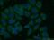 Rho GTPase Activating Protein 1 antibody, 11169-1-AP, Proteintech Group, Immunofluorescence image 