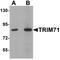 Tripartite Motif Containing 71 antibody, A08005, Boster Biological Technology, Western Blot image 