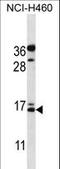BGP antibody, LS-C156805, Lifespan Biosciences, Western Blot image 