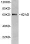 Telomeric Repeat Binding Factor 1 antibody, LS-C203075, Lifespan Biosciences, Western Blot image 