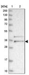 Transmembrane Protein 174 antibody, NBP1-82023, Novus Biologicals, Western Blot image 