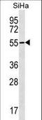 Ring Finger Protein 150 antibody, LS-C158868, Lifespan Biosciences, Western Blot image 