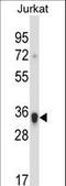 CD158 antigen-like family member H antibody, LS-C165529, Lifespan Biosciences, Western Blot image 
