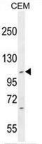 Intraflagellar Transport 88 antibody, AP52161PU-N, Origene, Western Blot image 