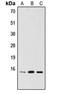 P53 And DNA Damage Regulated 1 antibody, orb215308, Biorbyt, Western Blot image 