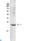 Interleukin 31 antibody, LS-C813890, Lifespan Biosciences, Western Blot image 