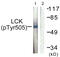 T cell-specific protein-tyrosine kinase antibody, OAAF07396, Aviva Systems Biology, Western Blot image 