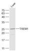 Triggering Receptor Expressed On Myeloid Cells 1 antibody, GTX51612, GeneTex, Western Blot image 