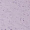 Dynein Axonemal Heavy Chain 10 antibody, HPA039066, Atlas Antibodies, Immunohistochemistry frozen image 