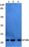 Glycoprotein Ib Platelet Subunit Beta antibody, A06258, Boster Biological Technology, Western Blot image 