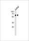 Nuclear Receptor Subfamily 2 Group C Member 2 antibody, PA5-35228, Invitrogen Antibodies, Western Blot image 