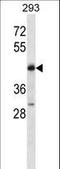 POU Class 4 Homeobox 2 antibody, LS-C163879, Lifespan Biosciences, Western Blot image 