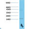 Transthyretin antibody, LS-C813253, Lifespan Biosciences, Western Blot image 