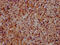Dymeclin antibody, CSB-PA007291LA01HU, Cusabio, Immunohistochemistry frozen image 