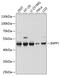 Inositol Polyphosphate-1-Phosphatase antibody, A09375, Boster Biological Technology, Western Blot image 